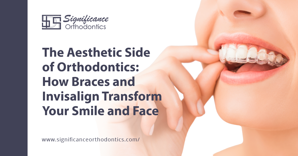 Woman holding clear aligner in mouth.