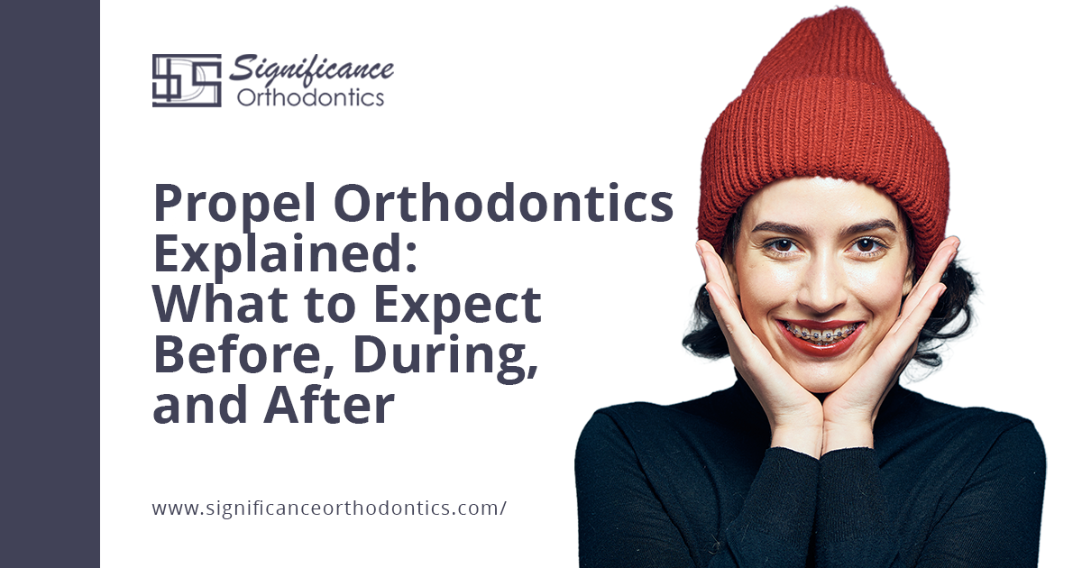smiling woman waering propel orthodontics holding her cheeks